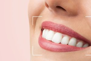 odontologia- estetica